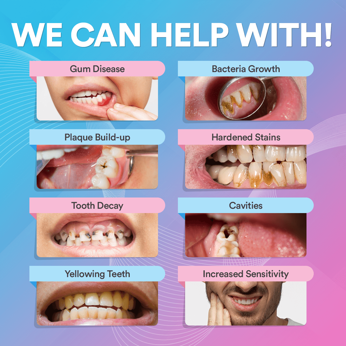 Ultrasonic Tooth Cleaner
