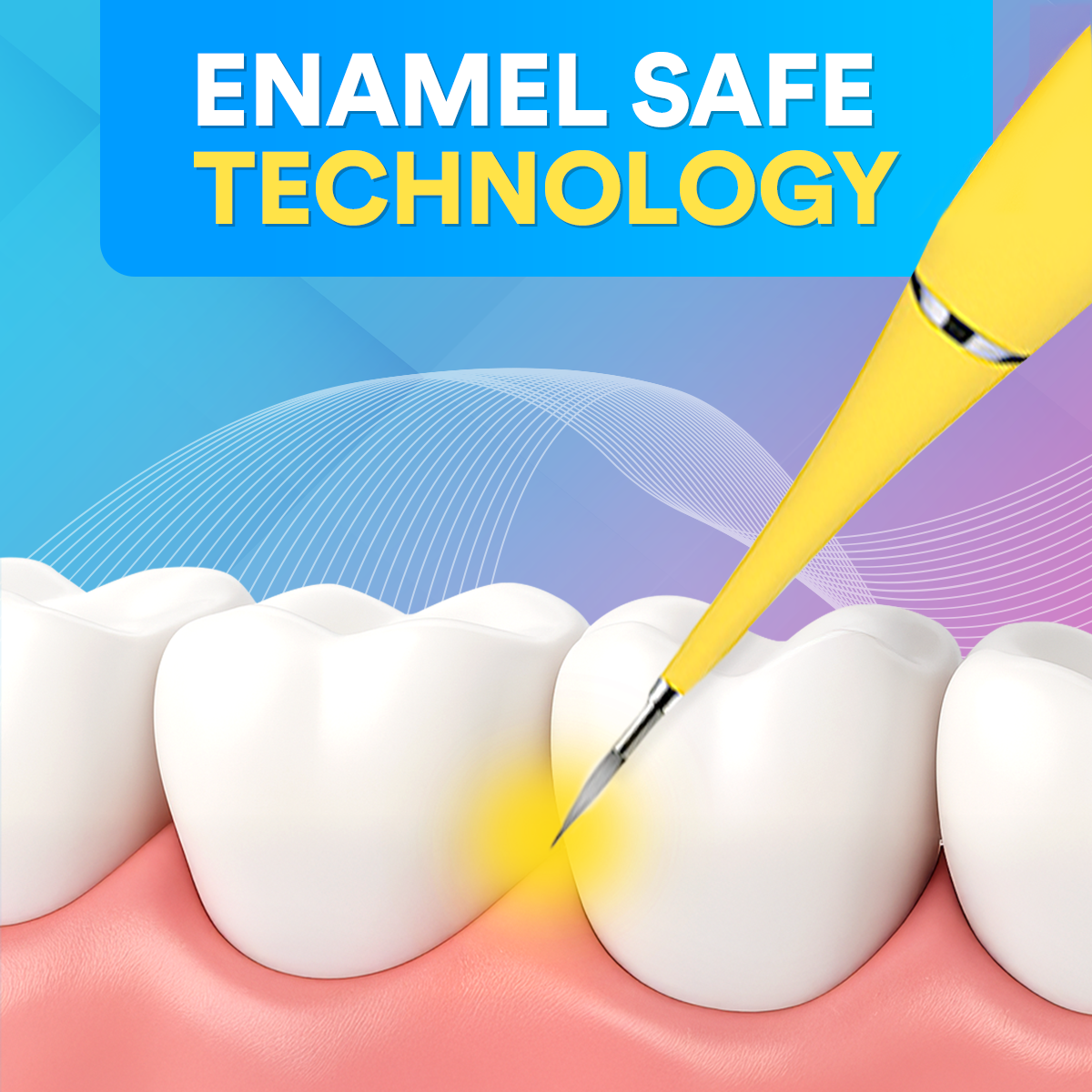 Ultrasonic Tooth Cleaner *BEST SELLER* TT1