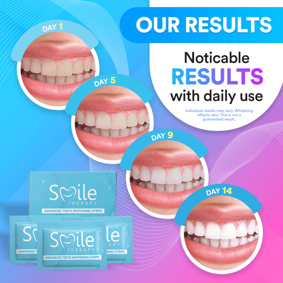 Teeth Cleaning & Whitening Strips (14 Treatments) TT1