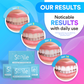 Teeth Whitening Strips
