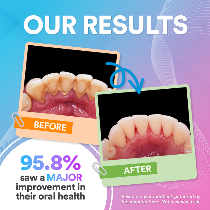 Dental Wireless 5-In-1 Water Flosser Pro DP5