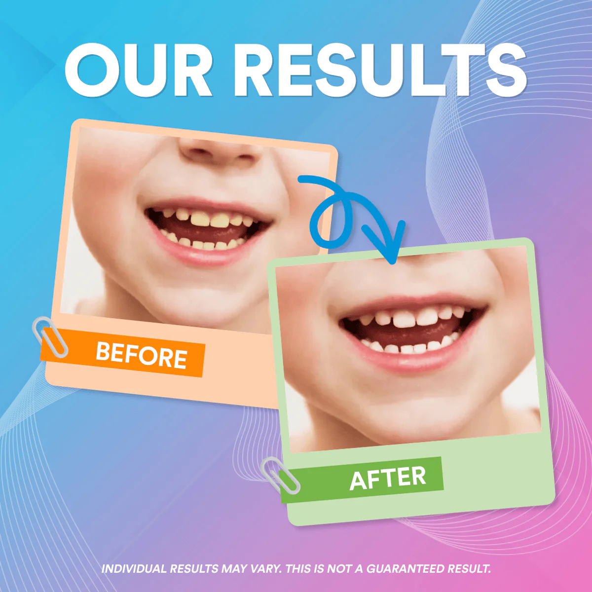 Kids Sonic Water Flosser 4-In-1