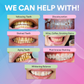 Teeth Whitening Powder