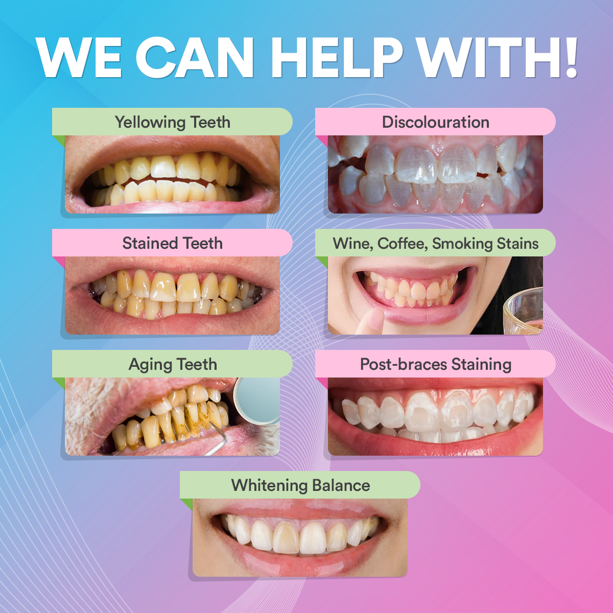 Teeth Whitening Powder