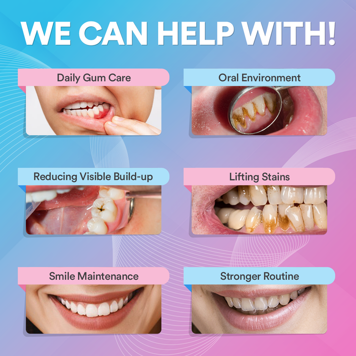 Ultrasonic Tooth Cleaner *BEST SELLER* TT1