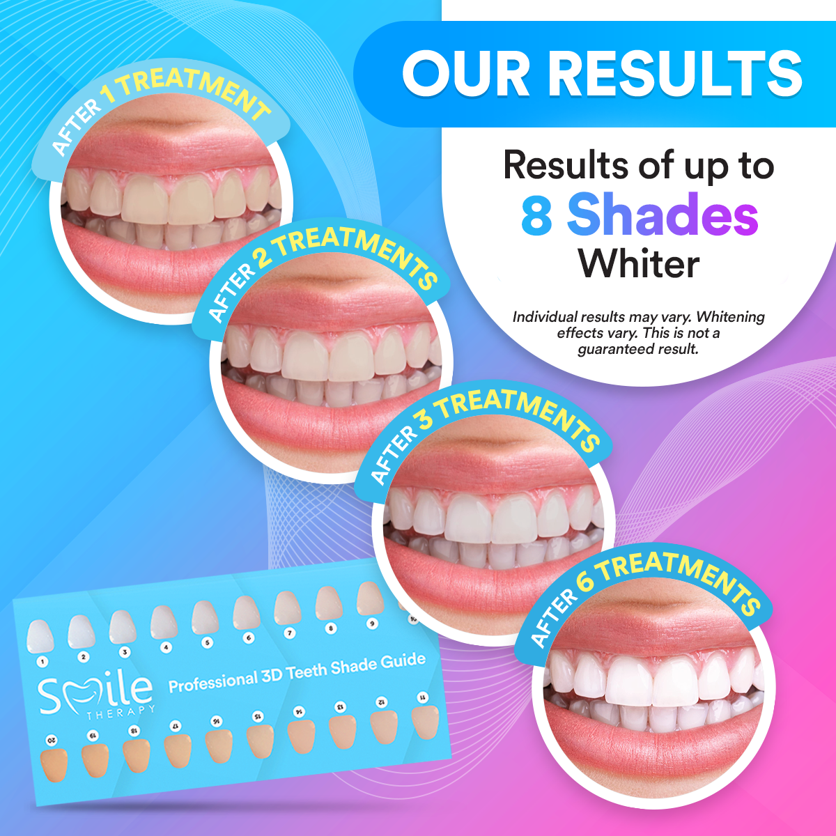 Advanced PAP+ Teeth Whitening Kit TT1