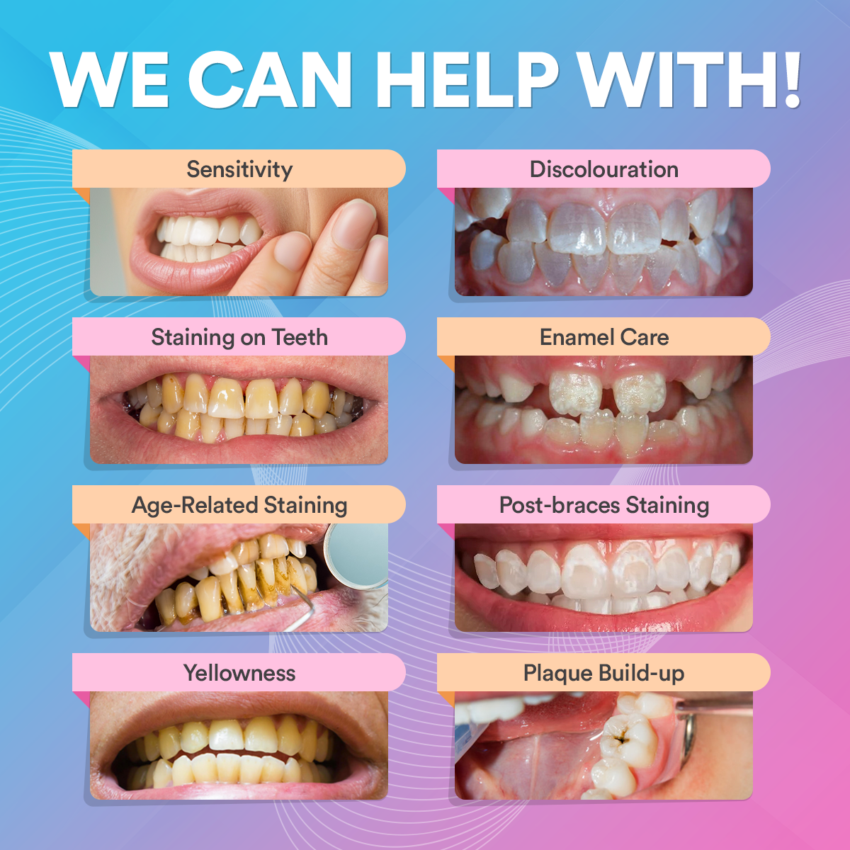 Advanced PAP+ Teeth Whitening Kit TT1