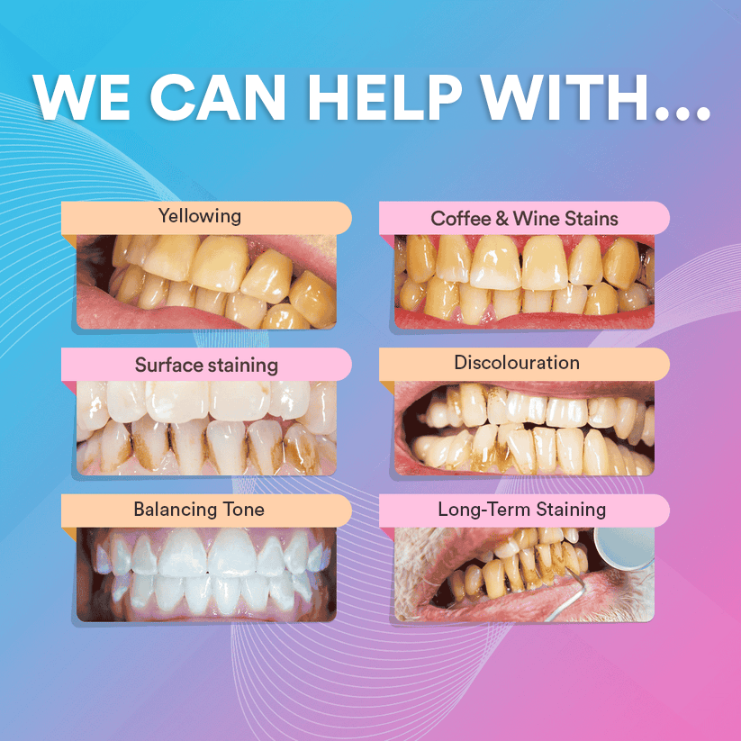 V34 Colour Corrector Serum TT1